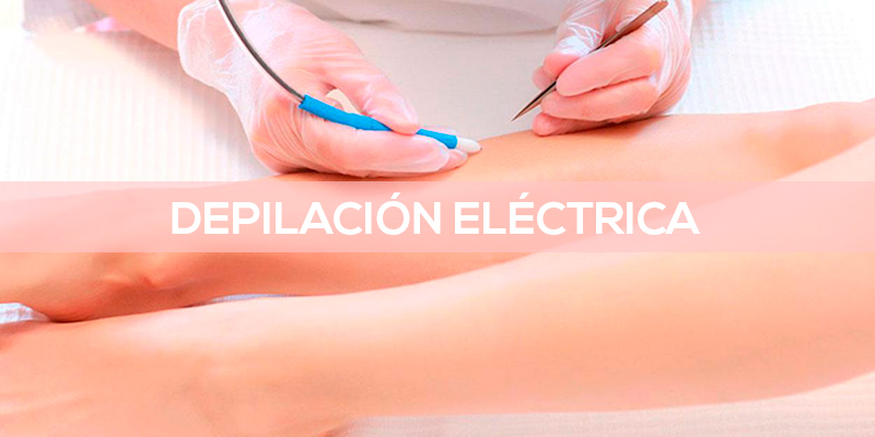 banner-electrica
