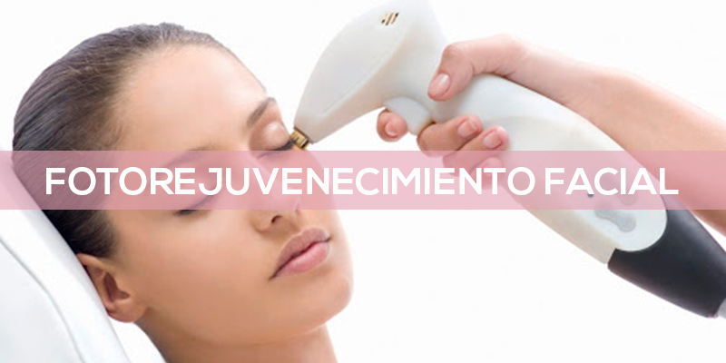 FOTOREJUVENECIMIENTO-FACIAL